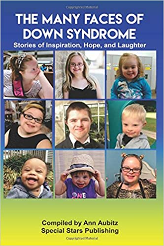 The Many Faces of Down Syndrome